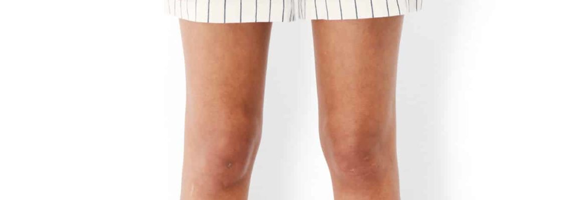 Striped linen shorts, mid-length