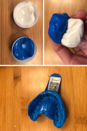Smile Brilliant impression kit