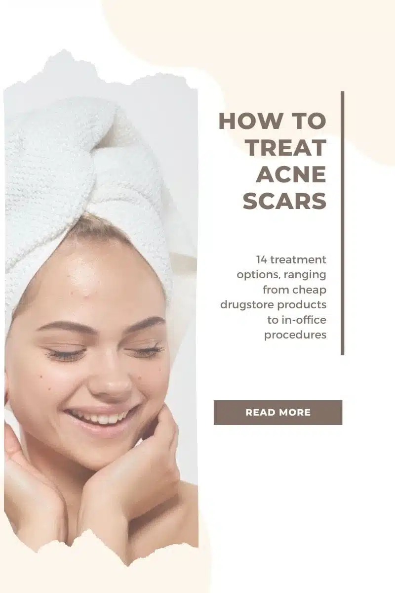 Fading Acne Scars: 14 Best Treatment Options 1 How to treat acne scars.